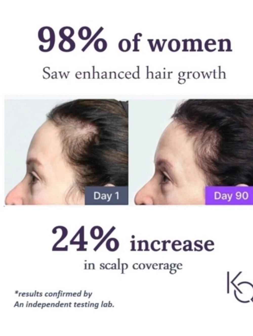 Keranique ✨️ Women’s 2% Minoxidil Topical Solution - Set Of 2. NIB